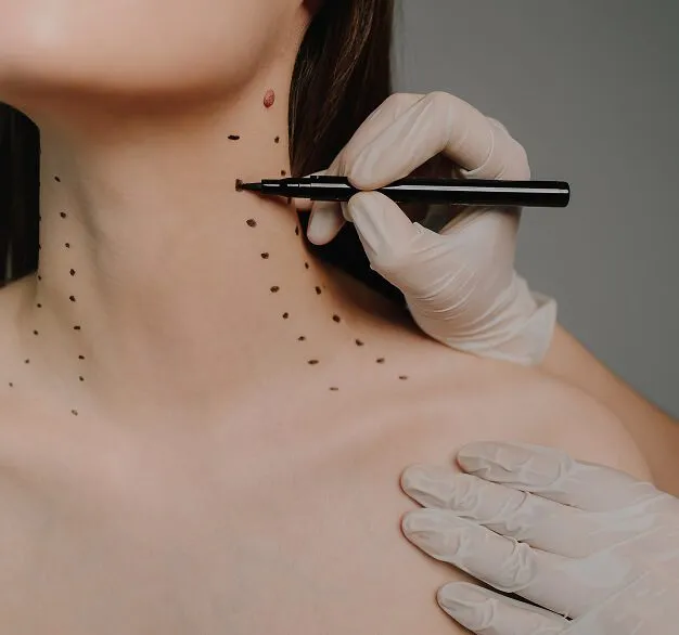 Why choose Neck Lift