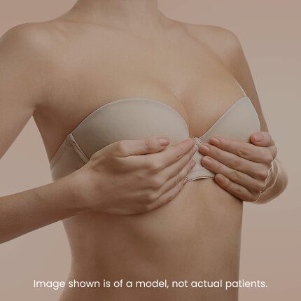 Breast Lift